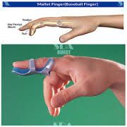 Фиксираща ортеза за пръст